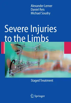 Lerner / Reis / Soudry |  Severe Injuries to the Limbs | eBook | Sack Fachmedien