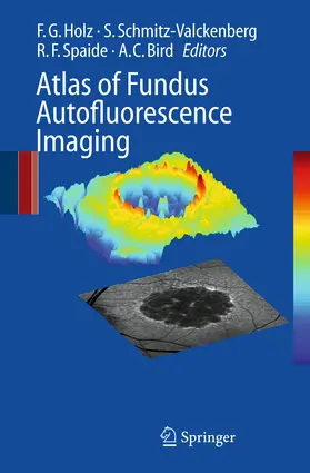 Holz / Schmitz-Valckenberg / Spaide |  Atlas of Fundus Autofluorescence Imaging | eBook | Sack Fachmedien