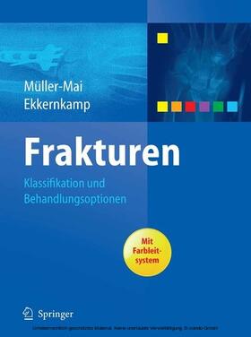 Müller-Mai / Ekkernkamp |  Frakturen | eBook | Sack Fachmedien