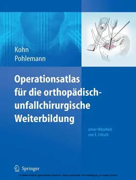 Kohn / Pohlemann |  Operationsatlas für die orthopädisch-unfallchirurgische Weiterbildung | eBook | Sack Fachmedien