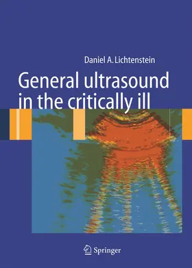 Lichtenstein |  General ultrasound in the critically ill | Buch |  Sack Fachmedien