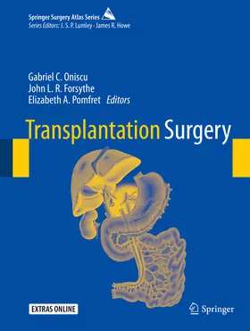 Oniscu / Forsythe / Pomfret |  Transplantation Surgery | eBook | Sack Fachmedien