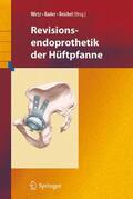 Wirtz / Reichel / Rader |  Revisionsendoprothetik der Hüftpfanne | Buch |  Sack Fachmedien