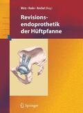 Wirtz / Rader / Reichel |  Revisionsendoprothetik der Hüftpfanne | eBook | Sack Fachmedien