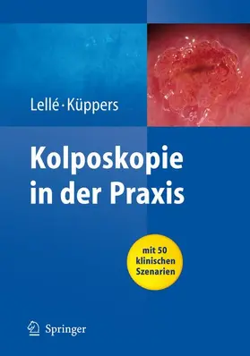 Lellé / Küppers | Kolposkopie in der Praxis | Buch | 978-3-540-78328-2 | www.sack.de
