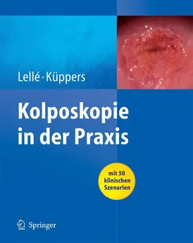 Lellé / Küppers | Kolposkopie in der Praxis | E-Book | www.sack.de