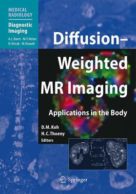 Koh / Thoeny | Koh, D: Diffusion-Weighted MR Imaging | Buch | 978-3-540-78575-0 | sack.de
