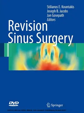 Kountakis / Jacobs / Gosepath |  Revision Sinus Surgery | eBook | Sack Fachmedien