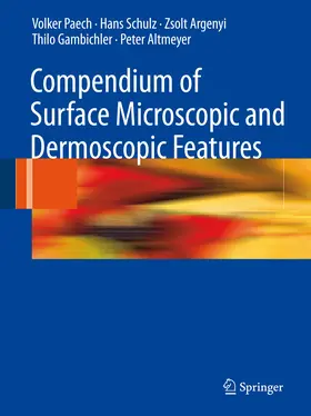 Paech / Schulz / Argenyi | Compendium of Surface Microscopic and Dermoscopic Features | E-Book | www.sack.de