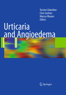 Zuberbier / Grattan / Maurer | Urticaria and Angioedema | E-Book | sack.de