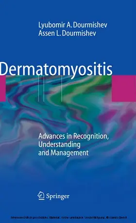 Dermatomyositis | E-Book | www.sack.de