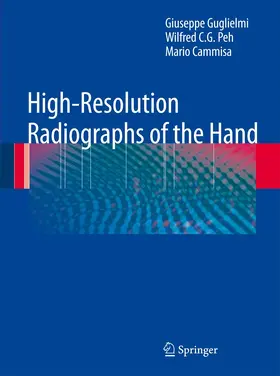 Guglielmi / Peh / Cammisa |  High-Resolution Radiographs of the Hand | Buch |  Sack Fachmedien
