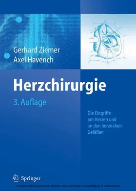Ziemer / Haverich |  Herzchirurgie | eBook | Sack Fachmedien