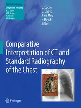 Coche / Ghaye / de Mey |  Comparative Interpretation of CT and Standard Radiography of the Chest | Buch |  Sack Fachmedien