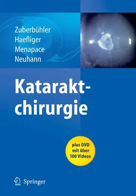 Zuberbuhler / Zuberbühler / Haefliger |  Kataraktchirurgie | eBook | Sack Fachmedien