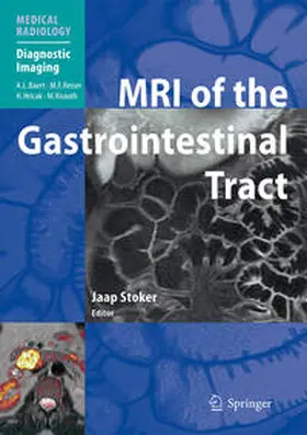 Stoker |  MRI of the Gastrointestinal Tract | eBook | Sack Fachmedien