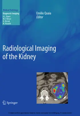 Quaia |  Radiological Imaging of the Kidney | eBook | Sack Fachmedien