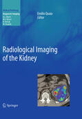 Quaia |  Radiological Imaging of the Kidney | eBook | Sack Fachmedien