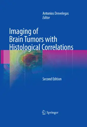 Drevelegas |  Imaging of Brain Tumors with Histological Correlations | eBook | Sack Fachmedien