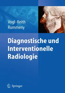 Vogl / Reith / Rummeny |  Diagnostische und interventionelle Radiologie | Buch |  Sack Fachmedien