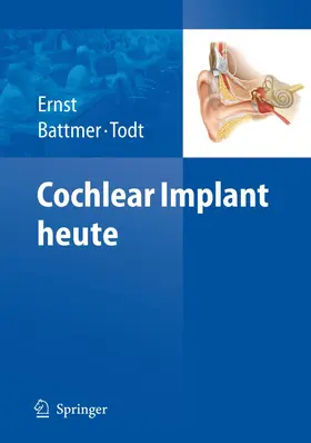 Ernst / Battmer / Todt | Cochlear Implant heute | Buch | 978-3-540-88235-0 | www.sack.de