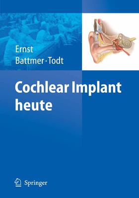 Ernst / Battmer / Todt |  Cochlear Implant heute | eBook | Sack Fachmedien