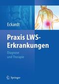 Eckardt |  Praxis LWS-Erkrankungen | Buch |  Sack Fachmedien
