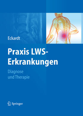 Eckardt | Praxis LWS-Erkrankungen | E-Book | sack.de