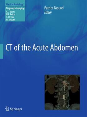 Taourel |  CT of the Acute Abdomen | Buch |  Sack Fachmedien