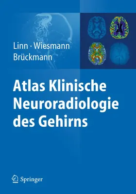 Linn / Wiesmann / Brückmann |  Atlas Klinische Neuroradiologie des Gehirns | Buch |  Sack Fachmedien