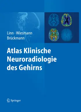 Linn / Wiesmann / Brückmann |  Atlas Klinische Neuroradiologie des Gehirns | eBook | Sack Fachmedien
