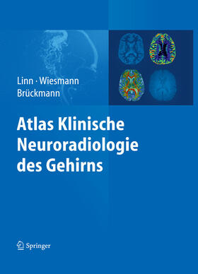 Linn / Wiesmann / Brückmann | Atlas Klinische Neuroradiologie des Gehirns | E-Book | sack.de