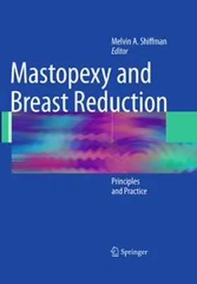 Shiffman |  Mastopexy and Breast Reduction | eBook | Sack Fachmedien