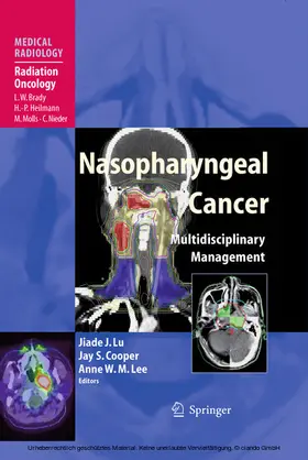 Lu / Cooper / Lee |  Nasopharyngeal Cancer | eBook | Sack Fachmedien