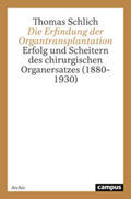 Schlich |  Die Erfindung der Organtransplantation | Buch |  Sack Fachmedien