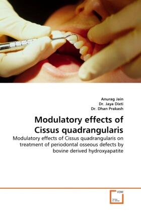 Jain |  Modulatory effects of Cissus quadrangularis | Buch |  Sack Fachmedien