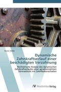 Müller |  Dynamische Zahnkraftverlauf einer beschädigten Verzahnung | Buch |  Sack Fachmedien