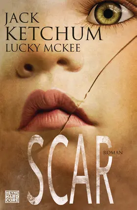 Ketchum / McGee |  SCAR | eBook | Sack Fachmedien