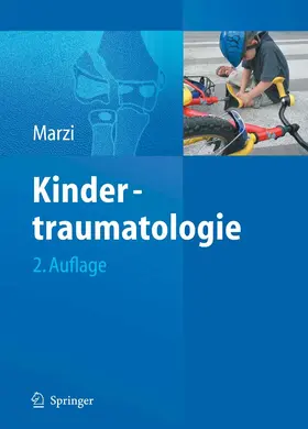 Marzi |  Kindertraumatologie | eBook | Sack Fachmedien