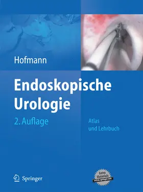 Hofmann |  Endoskopische Urologie | eBook | Sack Fachmedien