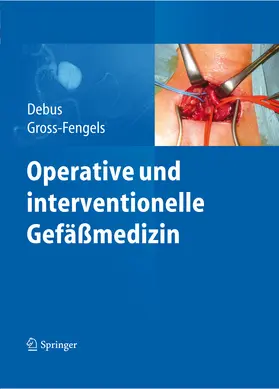 Debus / Gross-Fengels |  Operative und interventionelle Gefäßmedizin | eBook | Sack Fachmedien