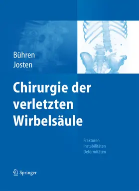 Bühren / Josten |  Chirurgie der verletzten Wirbelsäule | eBook | Sack Fachmedien
