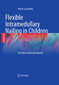 Lascombes |  Flexible Intramedullary Nailing in Children | eBook | Sack Fachmedien