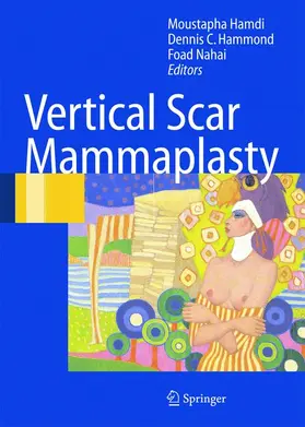Hamdi / Hammond / Nahai |  Vertical Scar Mammaplasty | Buch |  Sack Fachmedien