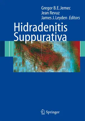 Jemec / Leyden / Revuz |  Hidradenitis Suppurativa | Buch |  Sack Fachmedien