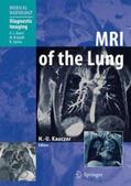 Kauczor |  MRI of the Lung | Buch |  Sack Fachmedien