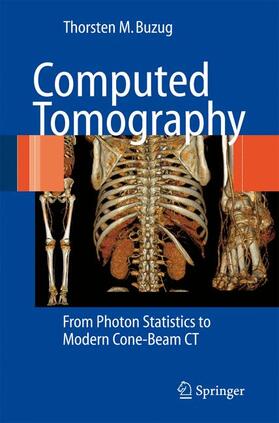 Buzug |  Computed Tomography | Buch |  Sack Fachmedien
