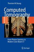 Buzug |  Computed Tomography | Buch |  Sack Fachmedien
