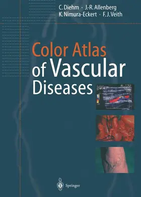 Diehm / Allenberg / Nimura-Eckert | Color Atlas of Vascular Diseases | Buch | 978-3-642-08296-2 | www.sack.de
