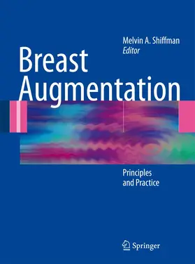 Shiffman |  Breast Augmentation | Buch |  Sack Fachmedien